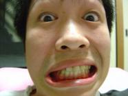 手術
